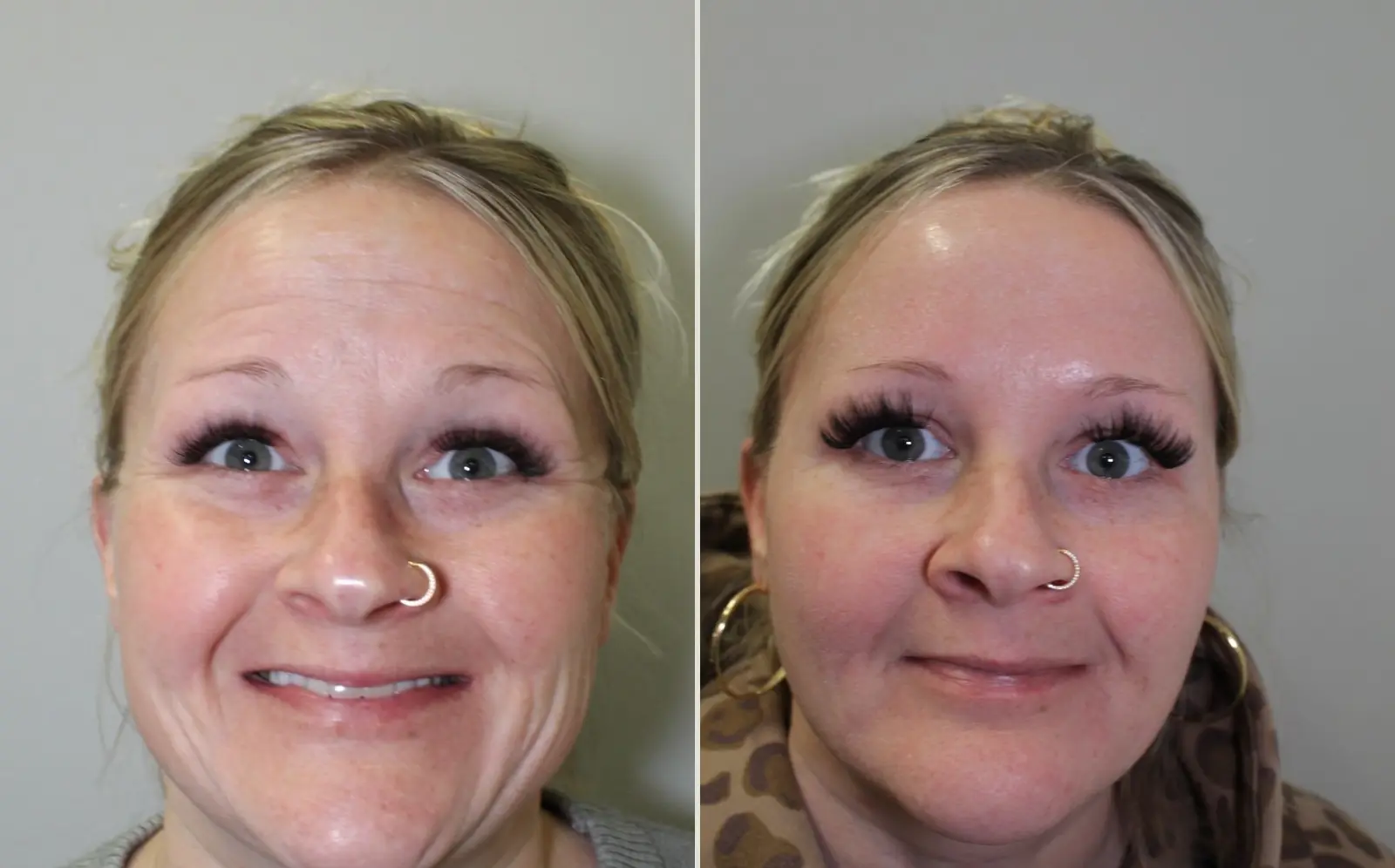 Before and after a treatment at Green Relief Health