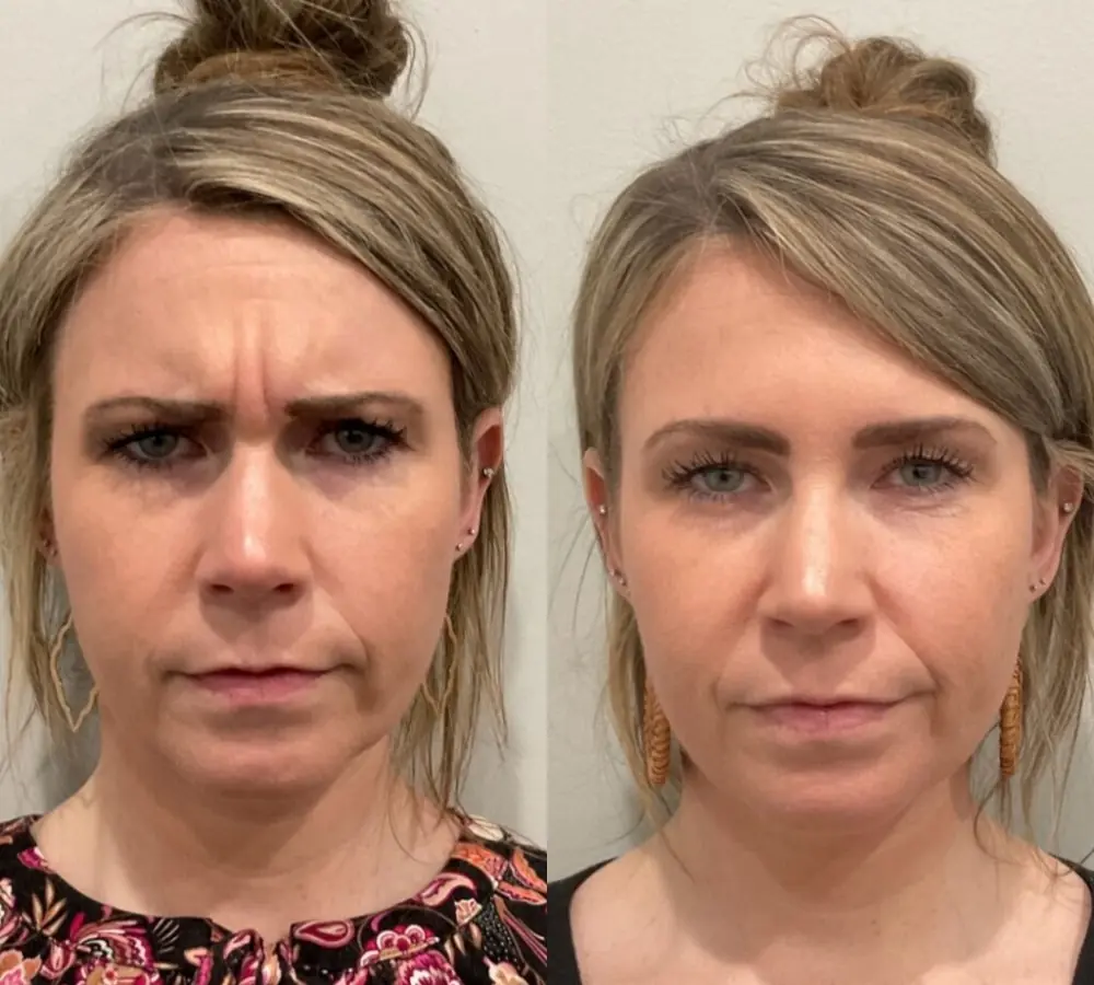 Before and after a treatment at Green Relief Health